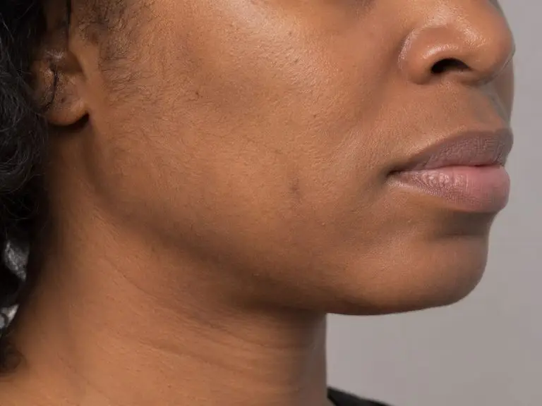 Diamond Dermaplane