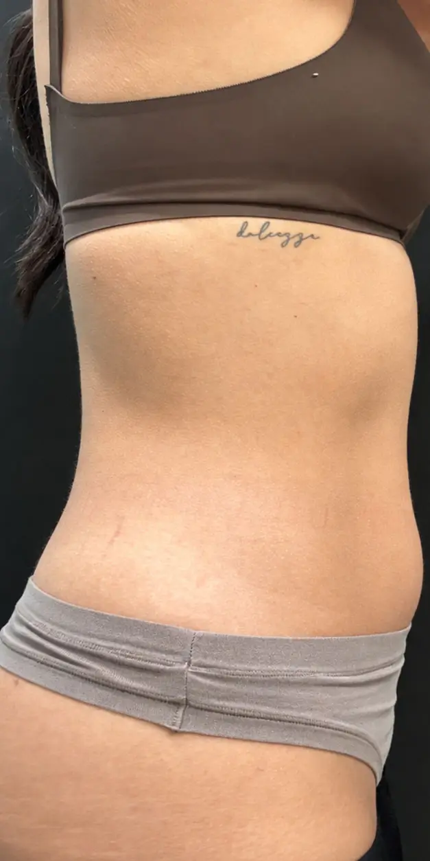 EvolveX Body Contouring