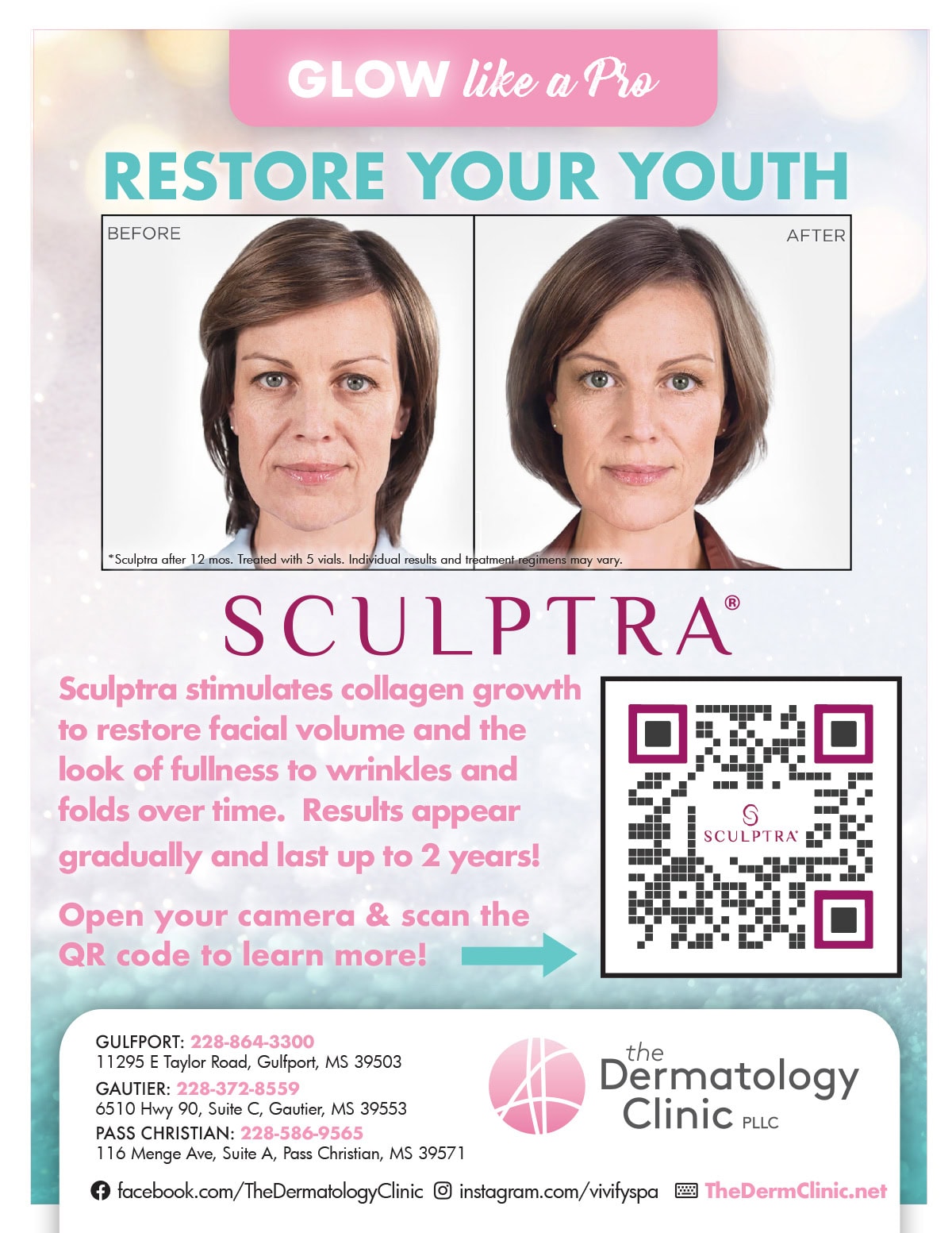 Sculptra Refresh