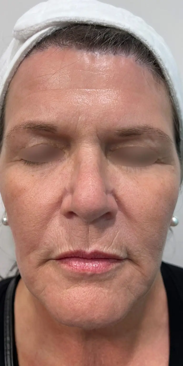 Opus Plasma