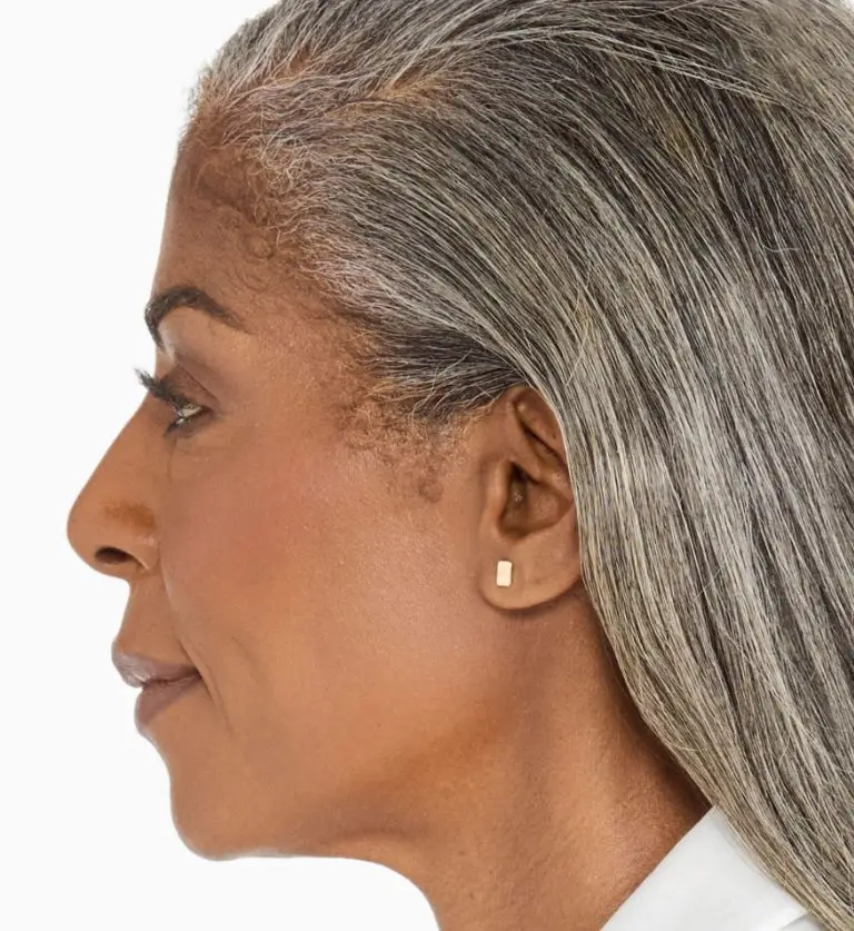 Ultherapy PRIME®