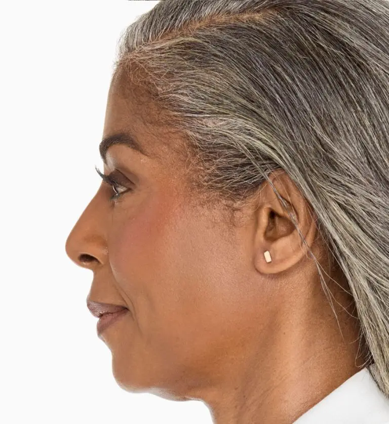 Ultherapy PRIME®