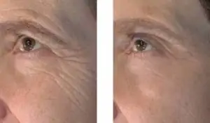 The Vivace Experience